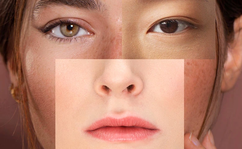 vacuum-rf-microneedling-machine-before-and-after.webp